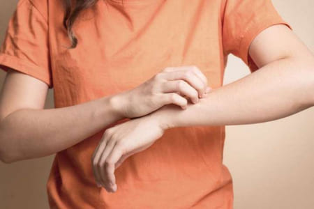 Распознать отравление кодеином Девушка в оранжевой одежде чешет руку